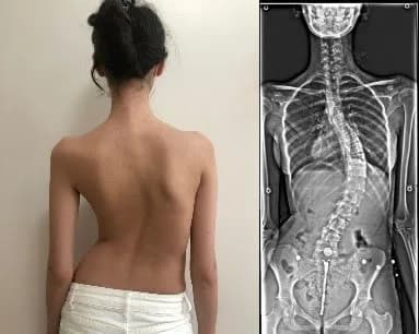 Şişli Kayropraktik Fizyoterapi: Mecidiyeköy Rehberi